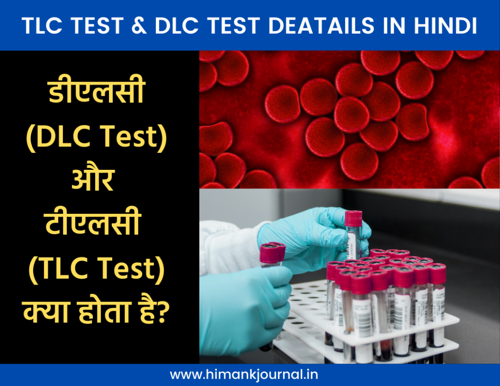 TLC Test in Hindi | DLC Test in Hindi | TLC test Kya hota hai | TLC test in India